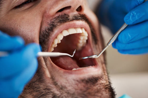 Best Emergency Dentist for Knocked-Out Tooth in Clearlake, CA