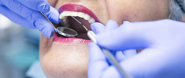 Best Emergency Dental Extractions in Clearlake, CA